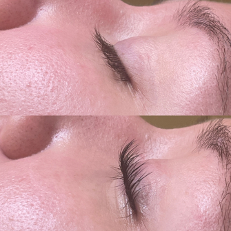 Lashes Client Example 